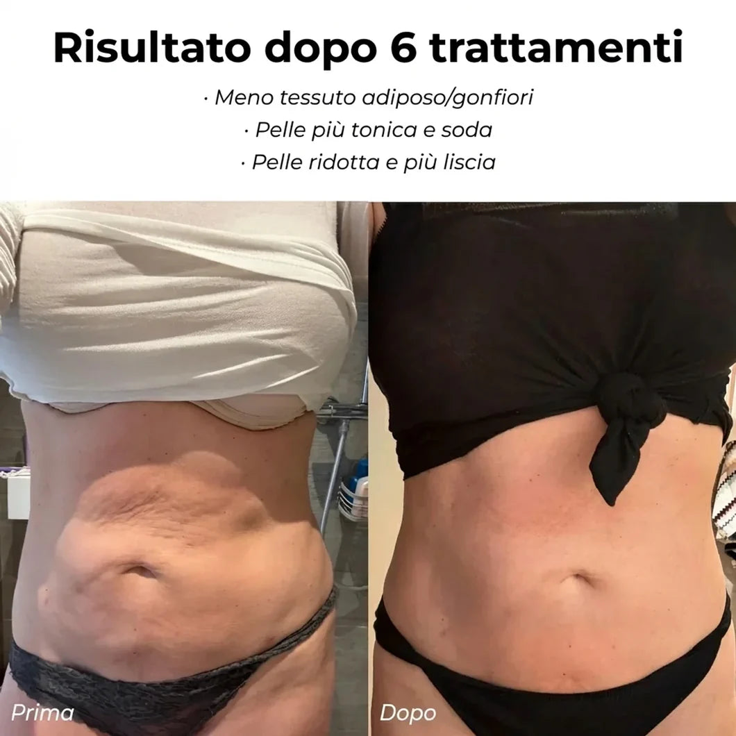Derma Lift Pro - Massaggiatore Anticellulite Rimodellante Corpo con Effetto Lifting